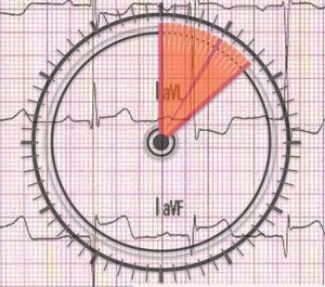 Patients who achieve ROSC after cardiac arrest are a wildly heterogeneous group with correspondingly variable courses of treatment.