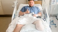 Ky. deputy wounded in ambush shooting undergoes surgery to amputate leg