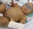 Pediatric emergencies: Different cases, different approaches