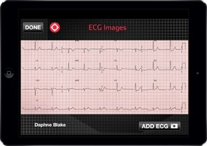 An ECG displayed on a tablet using Pulsara's software