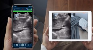 Clarius Live was unveiled at the annual American Institute of Ultrasound Medicine (AIUM), where it was demonstrated as fully integrated into the current version of the app with a single tap that prompts the user to enter an email or phone number for a live connection. (Photo/Clarius Mobile Health)