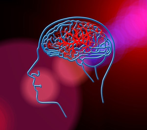Times are changing, and so is the way that we assess for a stroke.