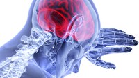 Study shows disparities in EMS use, hospital arrival for recurrent strokes