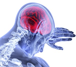Stroke in young adults is less common than it is in older adults, with only 10%-15% of all strokes occurring in people 18 to 50 years old. Prior research has documented a rise in strokes among younger adults.