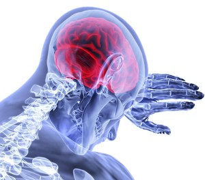 Some patient present with stroke-like signs and symptoms that are unrelated to a stroke.