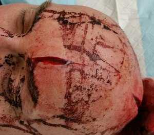 Senior Constable Andy Swift required 25 stitches after being attacked by a man with a samurai sword. (Photo/WA Police Union)