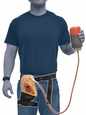 The TrueClot Inguinal Packing Trainer is a wearable training aid that simulates a junctional hemorrhage that cannot be treated with a tourniquet. Training “blood” is pumped through the device to simulate hemorrhage, and proper wound packing and compression will cause the simulated blood to clot and the hemorrhaging to stop.