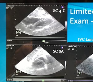 Pre-hospital portable ultrasound can provide diagnostic evidence to inform transport decisions.