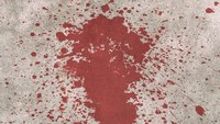 What cops should know about processing void blood patterns