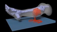 3-D video simulates severe bleeding for combat medics' training