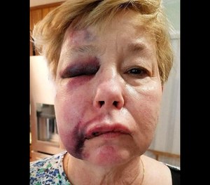 Veteran jailer Cathy Evans was treated at Decatur Morgan Hospital after the assault in April but has since returned to work.