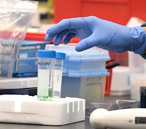 A researcher at Protein Sciences reaches for a vial in a lab, Thursday, March 12, 2020, in Meriden, Conn. The biotech company is currently researching a vaccine for COVID-19. (Photo/AP)