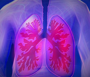 Chronic obstructive pulmonary disease is the third leading cause of death in the U.S.