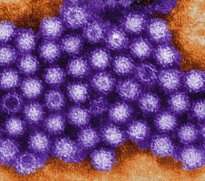 Infectious and contagious diseases are ever-present, and it takes considerable monitoring, countermeasures and prevention to ensure we protect the entire U.S. population.