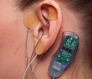 NSS-2 Bridge is a brain-stimulating device for patients suffering from debilitating withdrawal symptoms. (Courtesy of Innovative Health Solutions, Inc. via AP)