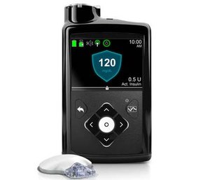 The device from Medtronic was approved Wednesday for patients with Type 1 diabetes, the kind usually diagnosed during childhood. (Medtronic via AP)