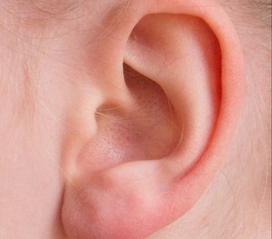 A 13-year-old girl with autism credits her hypersensitive hearing with helping her save her neighbor.