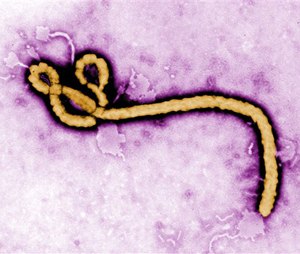 This colorized transmission electron micrograph shows an Ebola virus virion.