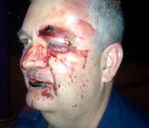 A Gold Coast paramedic was attacked by a patient in the back of an ambulance. (Queensland Ambulance Service Facebook photo)