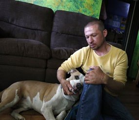 In this May 1, 2014 photo, Wayne Winkler, who suffered burns to 12 percent of his body when butane fumes ignited while he was making hash oil at home, pets his dog Bailey, in his living room, in Denver. (AP Image)