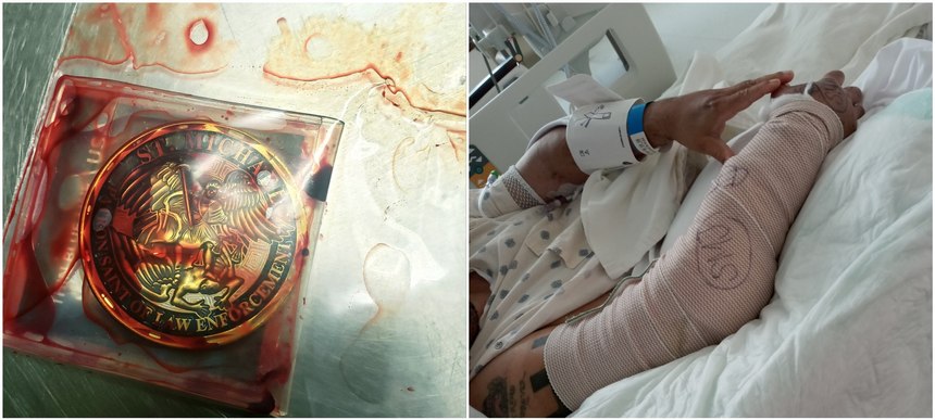 Left: Eddy's lucky challenge coin he received from a pastor that he carried for years in his right breast pocket is seen covered with his blood after the shooting. Right: Eddy's wounded arm in the hospital.