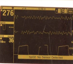 These tips are a stepping stone to producing a clean capnography waveform.