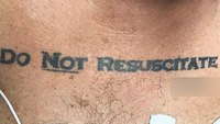 DNR tattoos: Are they legal and is EMS bound to comply?