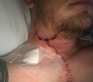 The bullet that nearly killed Sterrett ripped through his neck.