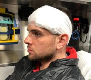 Correction Officer John Peloso needed at least five staples to close the wound on top of his head.