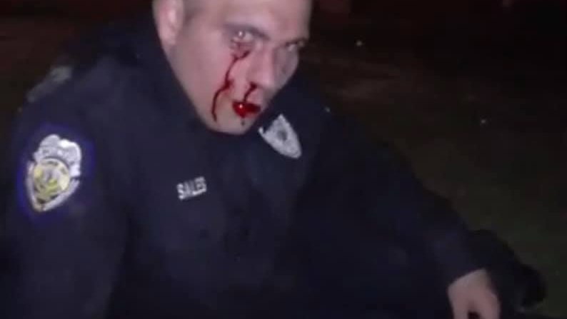 Police: cop hospitalized after he's beaten during arrest