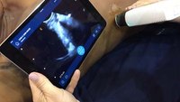 Clarius Mobile Health demonstrates wireless, handheld ultrasound scanners
