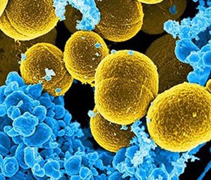 EMS personnel are the first line of defense in identifying and helping prevent the spread of infectious diseases.