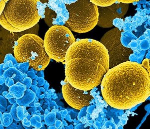 This digitally-colorized scanning electron micrograph (SEM) depicts a number of mustard-colored, spheroid-shaped Staphylococcus aureus bacteria that were in the process of escaping their destruction by blue-colored human white blood cells.