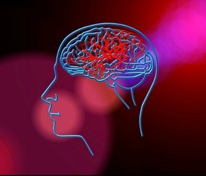 Stroke is the number one cause of disability in the United States. (Photo/Pixabay)