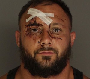Tanner Boyd Graybill, 33, is charged with aggravated assault for allegedly spitting blood in a paramedic's face after injuring himself in a patrol vehicle.