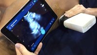 How EMS ultrasound will transform prehospital care