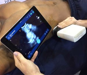About 4 percent of EMS agencies in the United States currently use ultrasound, although about 21 percent are considering adding the technology.