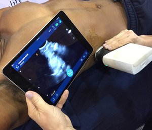 A handheld wireless ultrasound scanner.