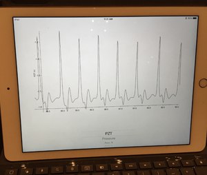 Monitoring the effectiveness of chest compressions during cardiac arrest resuscitation is another potential application of the device.