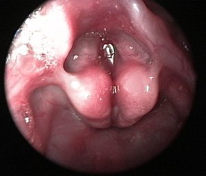 Setting providers up for success takes practice, and practice is required for both successful direct and video laryngoscopy use. (Photo/U.S. National Library of Medicine)
