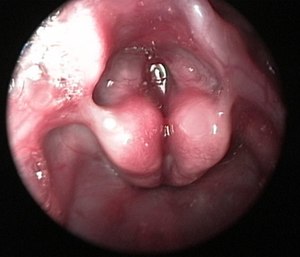 Setting providers up for success takes practice, and practice is required for both successful direct and video laryngoscopy use.