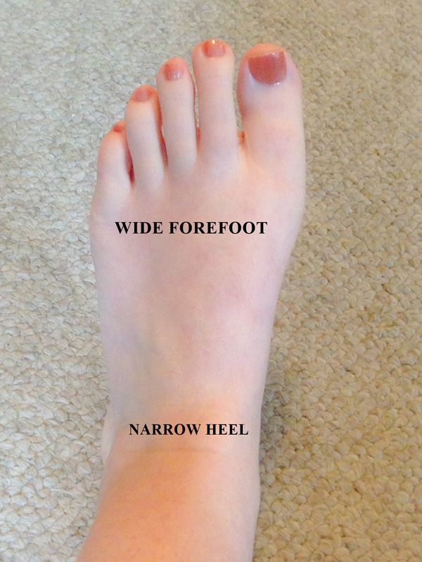wide toes narrow heel