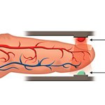 Pulse Oximetry