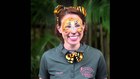 911 call: Tiger attack at Palm Beach Zoo