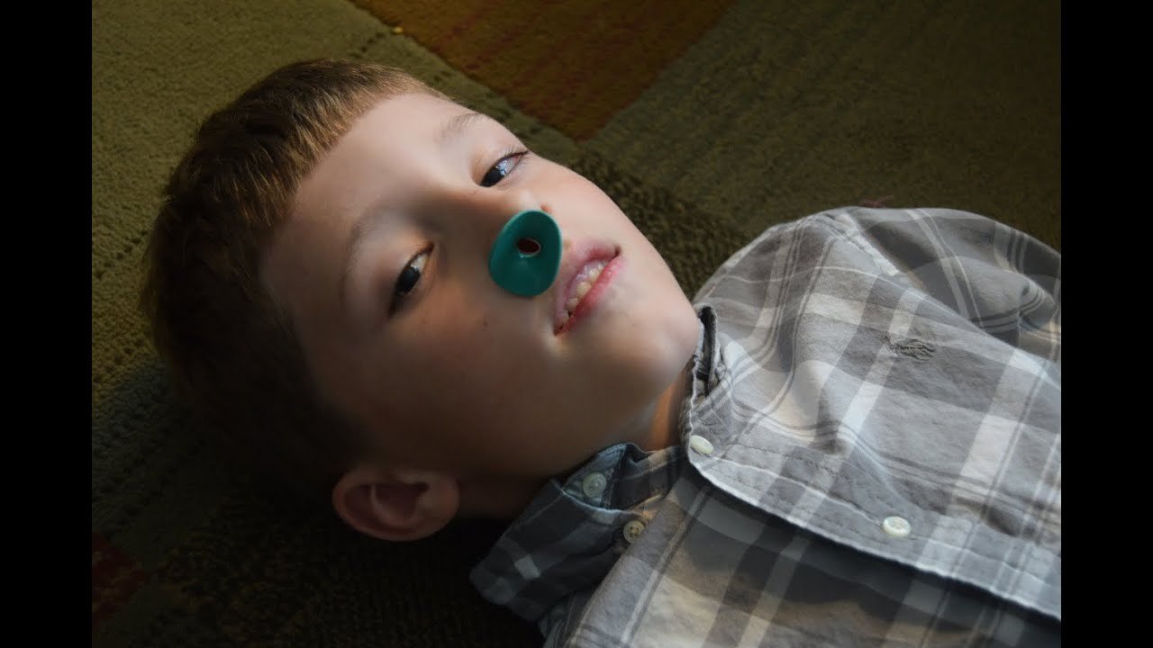 Video: Does your patient have an intact gag reflex?