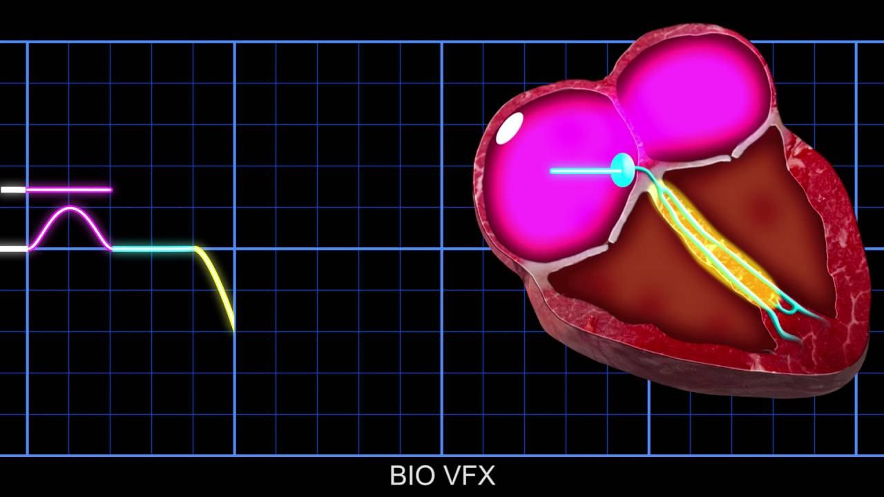 Video: Animation: Conduction of electrical impulses through the heart