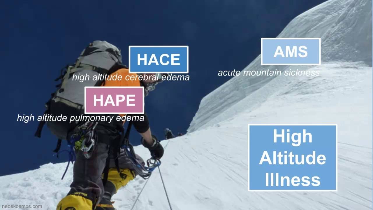 Acute High Point Acute Altitude Illness: Updated Prevention And Treatment – HTITLI