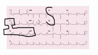 Tip: Associate anatomical locations on a 12-lead ECG