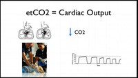 Use capnography for a patient in cardiac arrest