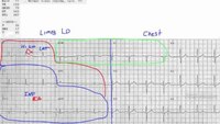 How to map an ECG